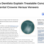 San Diego Cosmetic Dentists Outline Distinctions Between Crowns and Veneers