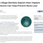 La Jolla Cosmetic Dentists Explain How Implant Dentures Can Strengthen Bone Volume