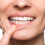 Woman Checking Teeth Gums.
