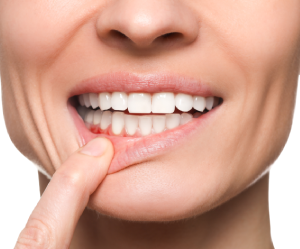 Woman Checking Teeth Gums.