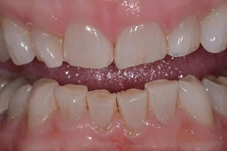 bna-sample